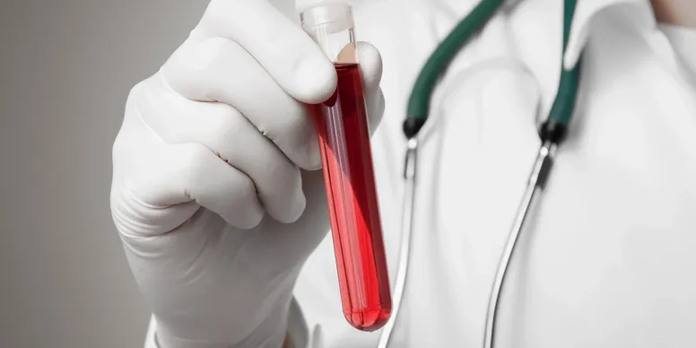 A close up of a dr's hands holding a vial with a red liquid